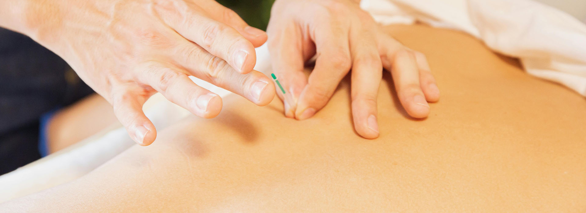 Akupunkturklinik i Skagen